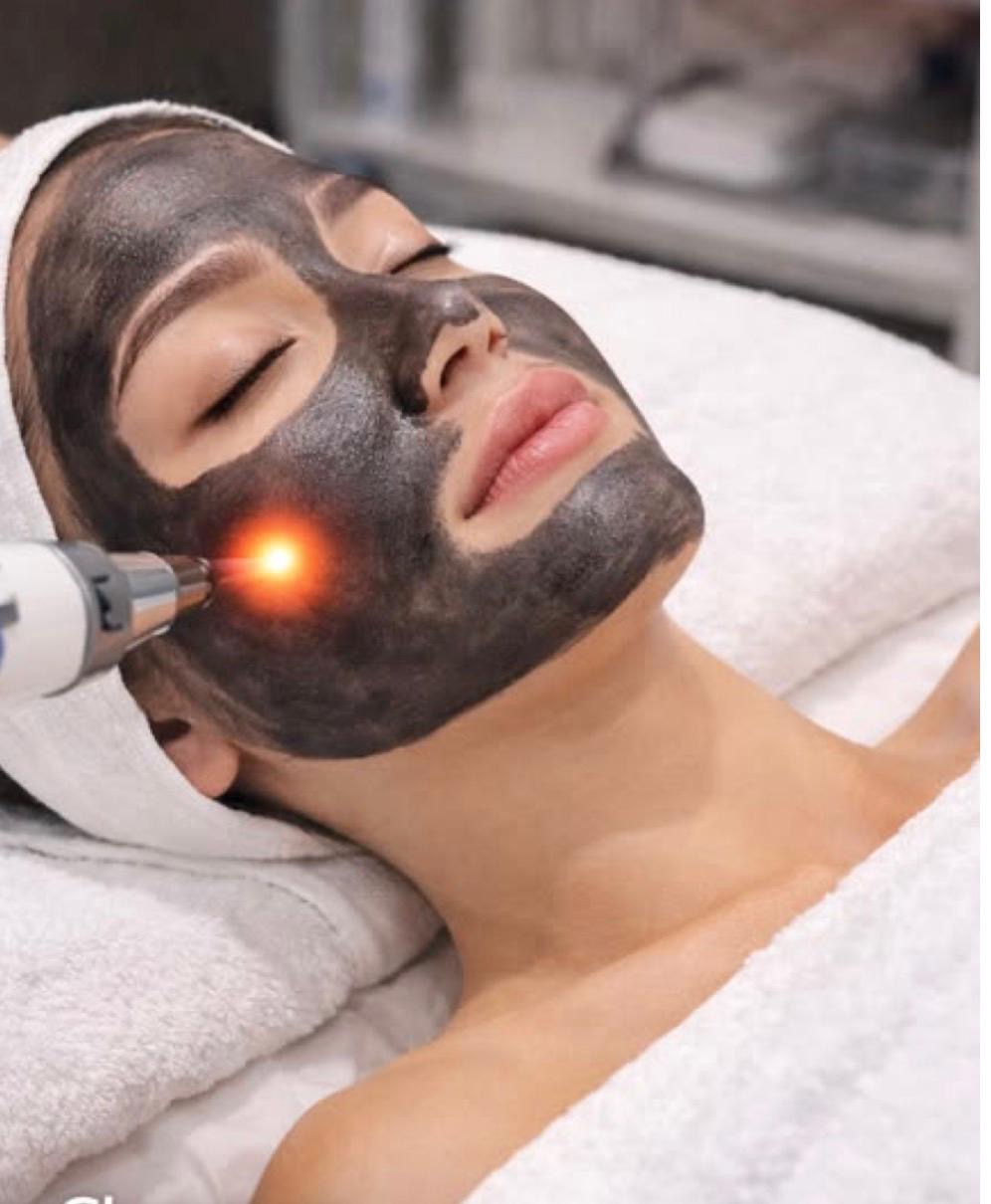 Carbon Peeling