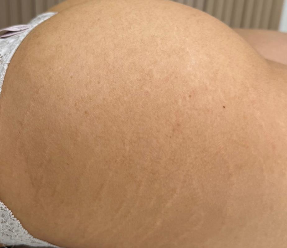 Na
